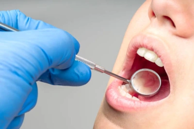 Periodontal Maintenance  